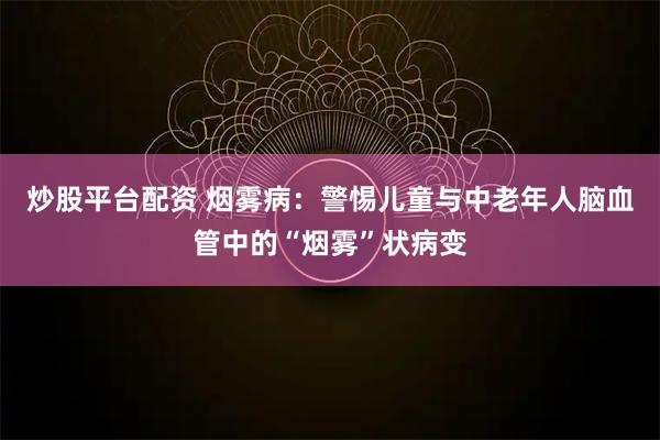 炒股平台配资 烟雾病：警惕儿童与中老年人脑血管中的“烟雾”状病变